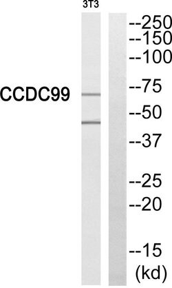 SPDL1 Polyclonal Antibody, Invitrogen 100 &mu;g; Unconjugated:Antibodies,