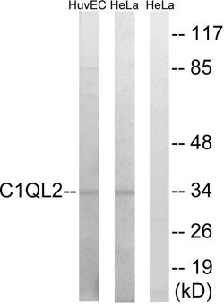 C1QL2 Polyclonal Antibody, Invitrogen 100 &mu;g; Unconjugated:Antibodies,
