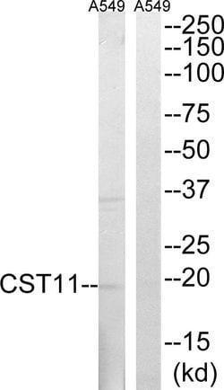CST11 Polyclonal Antibody, Invitrogen 100 &mu;g; Unconjugated:Antibodies,