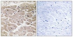 CCP2 Polyclonal Antibody, Invitrogen 100 &mu;g; Unconjugated:Antibodies,