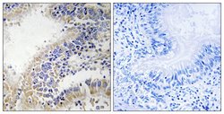 DHODH Polyclonal Antibody, Invitrogen 100 &mu;g; Unconjugated:Antibodies,