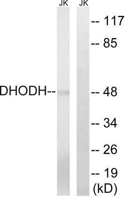 DHODH Polyclonal Antibody, Invitrogen 100 &mu;g; Unconjugated:Antibodies,