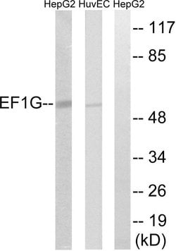 EEF1G Polyclonal Antibody, Invitrogen 100 &mu;g | Buy Online | Invitrogen | Fisher Scientific