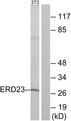 KDELR3 Polyclonal Antibody, Invitrogen 100 &mu;g; Unconjugated:Antibodies,