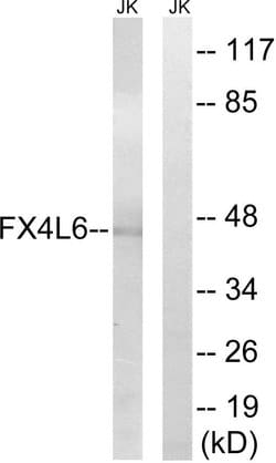 FOXD4/L2/L3/L4/L5/L6 Polyclonal Antibody, Invitrogen 100 &mu;g; Unconjugated:Antibodies,