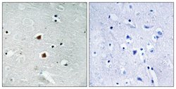 FOXJ3 Polyclonal Antibody, Invitrogen 100 &mu;g; Unconjugated:Antibodies,