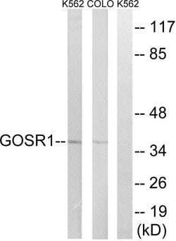 GOSR1 Polyclonal Antibody, Invitrogen 100 μg; Unconjugated:Antibodies,