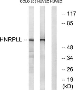 hnRNP LL Polyclonal Antibody, Invitrogen 100 &mu;g | Buy Online | Thermo Scientific | Fisher Scientific
