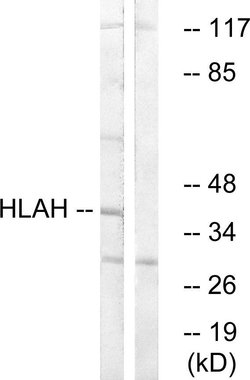 HLA-H Polyclonal Antibody, Invitrogen 100 &mu;g | Buy Online | Invitrogen | Fisher Scientific