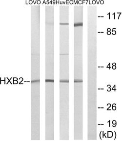 HOXB2 Polyclonal Antibody, Invitrogen 100 &mu;g; Unconjugated:Antibodies,