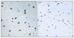 KLHL29 Polyclonal Antibody, Invitrogen 100 &mu;g; Unconjugated:Antibodies,