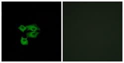 Ly-6E Polyclonal Antibody, Invitrogen 100 μg; Unconjugated:Antibodies,