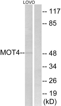 SLC16A3 Polyclonal Antibody, Invitrogen 100 μg; Unconjugated:Antibodies,