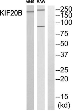 MPHOSPH1 Polyclonal Antibody, Invitrogen 100 &mu;g; Unconjugated:Antibodies,