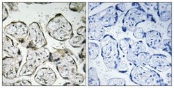 MT-ND1 Polyclonal Antibody, Invitrogen 100 &mu;g; Unconjugated:Antibodies,