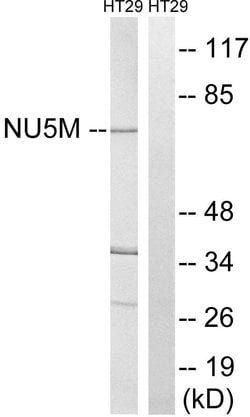 MT-ND5 Polyclonal Antibody, Invitrogen 100 &mu;g | Buy Online | Invitrogen | Fisher Scientific
