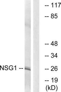 NSG1 Polyclonal Antibody, Invitrogen 100 &mu;g; Unconjugated:Antibodies,