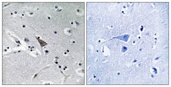 SLC6A16 Polyclonal Antibody, Invitrogen 100 &mu;g; Unconjugated:Antibodies,