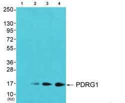 PDRG1 Polyclonal Antibody, Invitrogen 100 μg; Unconjugated:Antibodies,