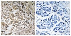 PEX11G Polyclonal Antibody, Invitrogen 100 &mu;g; Unconjugated:Antibodies,