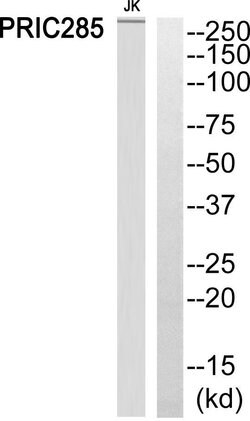 HELZ2 Polyclonal Antibody, Invitrogen 100 &mu;g; Unconjugated:Antibodies,