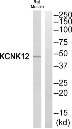 KCNK12 Polyclonal Antibody, Invitrogen 100 &mu;g; Unconjugated:Antibodies,
