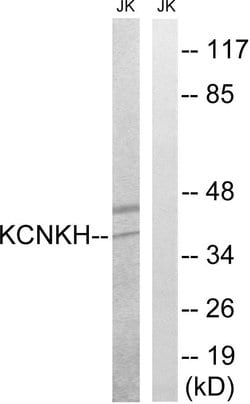 KCNK17 Polyclonal Antibody, Invitrogen 100 &mu;g; Unconjugated:Antibodies,