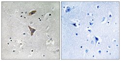 KCNT1 Polyclonal Antibody, Invitrogen 100 &mu;g; Unconjugated:Antibodies,