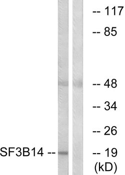 SF3B14 Polyclonal Antibody, Invitrogen 100 &mu;g; Unconjugated:Antibodies,