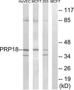 PRPF18 Polyclonal Antibody, Invitrogen 100 &mu;g; Unconjugated:Antibodies,