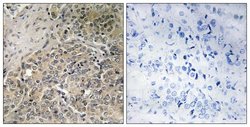 A26C2/A26C3 Polyclonal Antibody, Invitrogen 100 &mu;g; Unconjugated:Antibodies,
