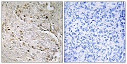 POTEA Polyclonal Antibody, Invitrogen 100 &mu;g; Unconjugated:Antibodies,