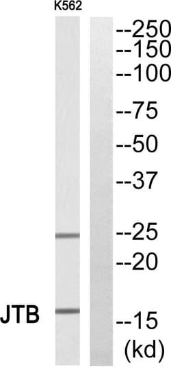 JTB Polyclonal Antibody, Invitrogen 100 &mu;g; Unconjugated:Antibodies,