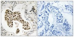 PMS2/PMS2CL Polyclonal Antibody, Invitrogen 100 &mu;g; Unconjugated:Antibodies,