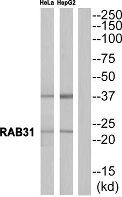 RAB31 Polyclonal Antibody, Invitrogen 100 &mu;g; Unconjugated:Antibodies,