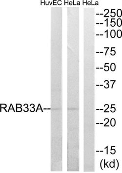 RAB33A Polyclonal Antibody, Invitrogen 100 &mu;g | Buy Online | Invitrogen | Fisher Scientific