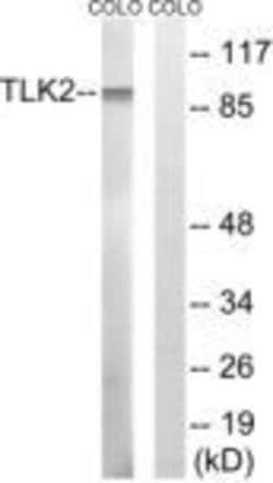 TLK2 Polyclonal Antibody, Invitrogen 100 &mu;g; Unconjugated:Antibodies,