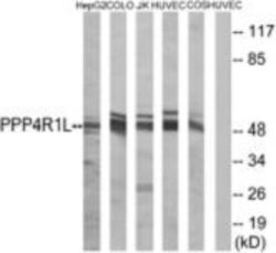 PPP4R1L Polyclonal Antibody, Invitrogen 100 &mu;g; Unconjugated:Antibodies,