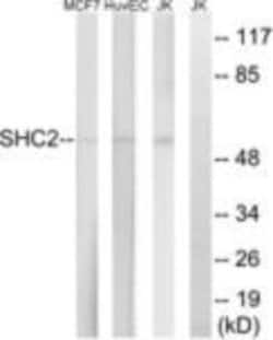 SCK Polyclonal Antibody, Invitrogen 100 &mu;g; Unconjugated:Antibodies,