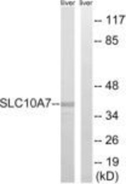 SLC10A7 Polyclonal Antibody, Invitrogen 100 &mu;g | Buy Online | Invitrogen | Fisher Scientific