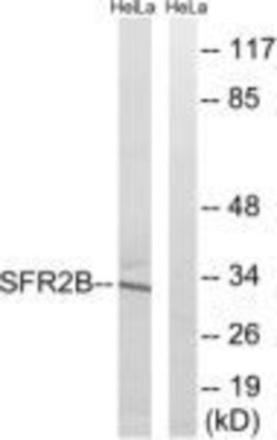 SRSF8 Polyclonal Antibody, Invitrogen 100 &mu;g; Unconjugated:Antibodies,