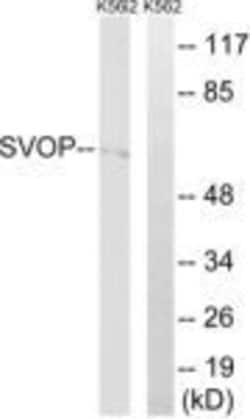 SVOP Polyclonal Antibody, Invitrogen 100 &mu;g | Buy Online | Invitrogen | Fisher Scientific