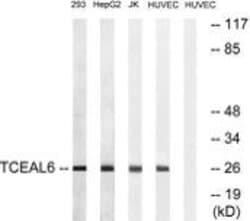 TCEAL6 Polyclonal Antibody, Invitrogen 100 &mu;g; Unconjugated:Antibodies,