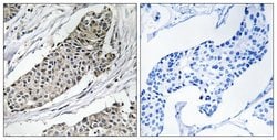 KCNAB3 Polyclonal Antibody, Invitrogen 100 &mu;g; Unconjugated:Antibodies,