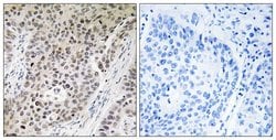 ZNF608 Polyclonal Antibody, Invitrogen 100 &mu;g; Unconjugated:Antibodies,