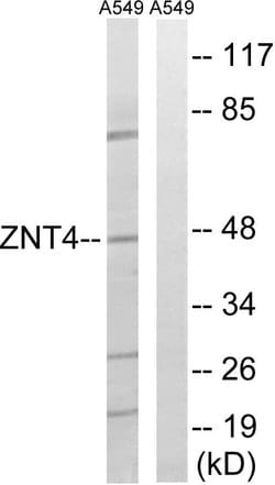 SLC30A4 Polyclonal Antibody, Invitrogen 100 &mu;g; Unconjugated:Antibodies,