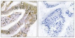 TACC3 Polyclonal Antibody, Invitrogen 100 μg; Unconjugated:Antibodies,