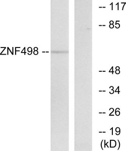 ZNF498 Polyclonal Antibody, Invitrogen 100 &mu;g; Unconjugated:Antibodies,