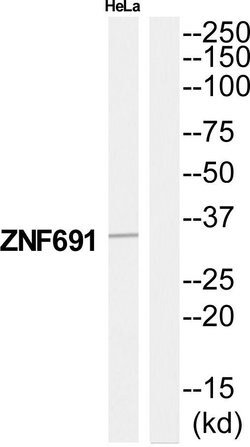 ZNF691 Polyclonal Antibody, Invitrogen 100 &mu;g; Unconjugated:Antibodies,