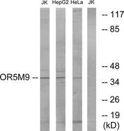 OR5M9 Polyclonal Antibody, Invitrogen 100 &mu;g; Unconjugated:Antibodies,